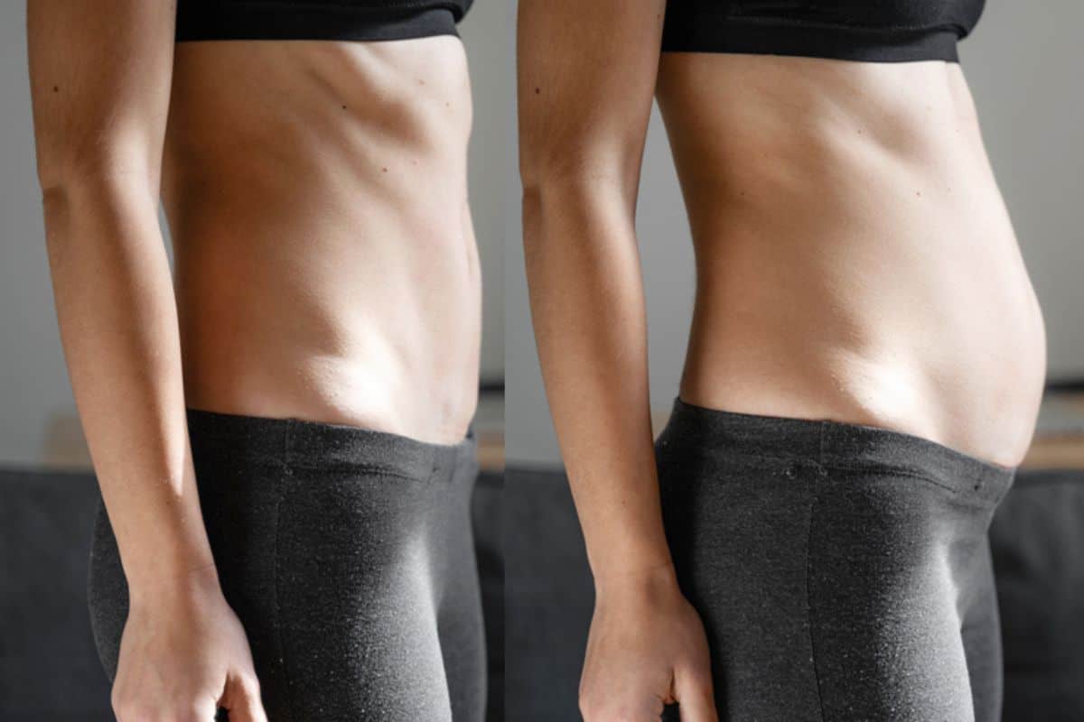 How long does diastasis recti take to improve West Mersea?