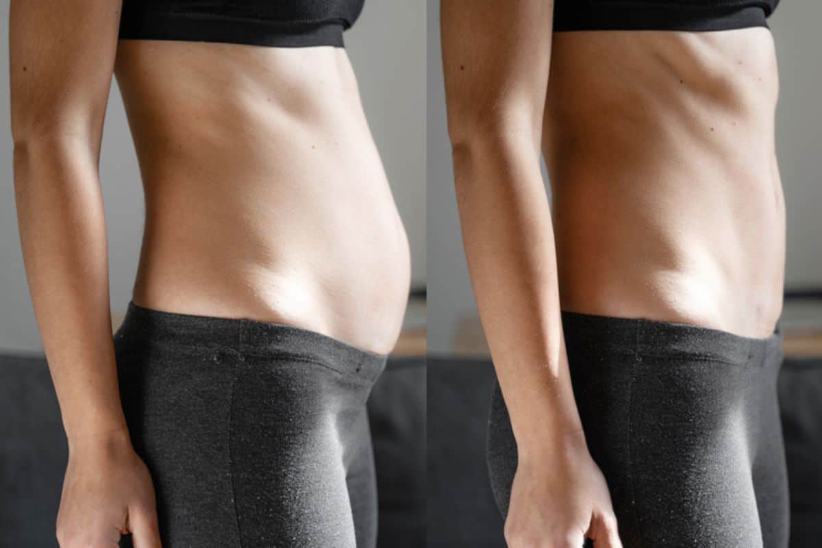 Post-Pregnancy: What Happens to Your Abdominal Muscles After Birth West Mersea