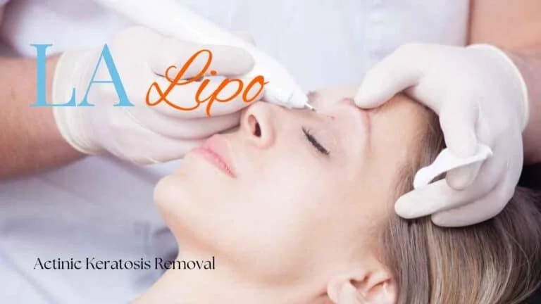 Woman receiving Actinic Keratosis Removal Treatment West Mersea