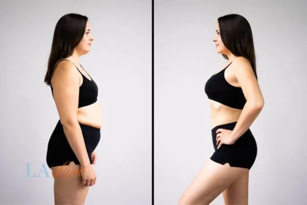 link between body image and mental health West Mersea
