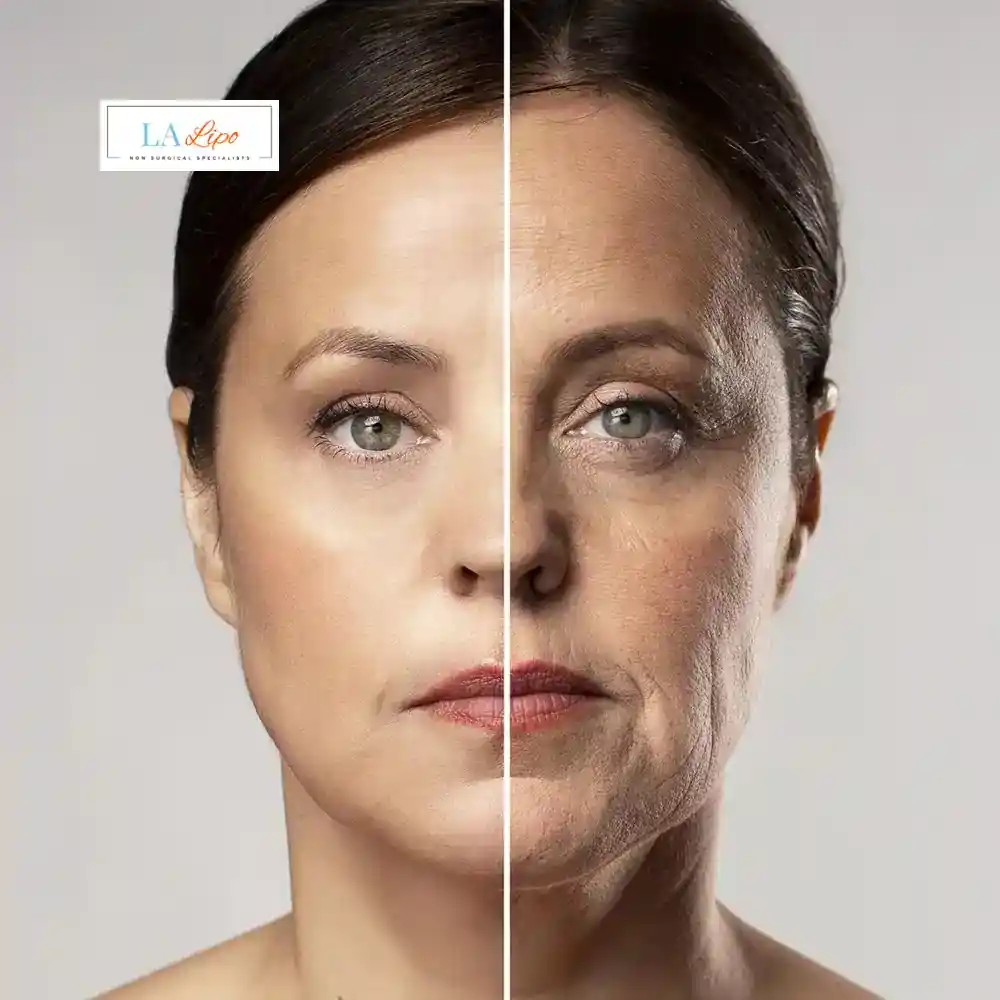 How Can You Tell If Non-Surgical Skin Tightening Is Right for You West Mersea?