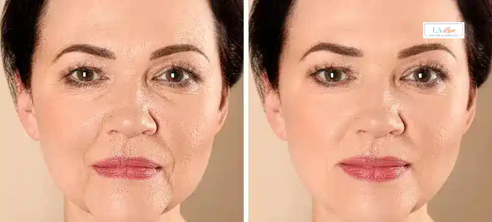 Why Aren’t My Skincare Products Making My Sagging Skin Look Firmer West Mersea?