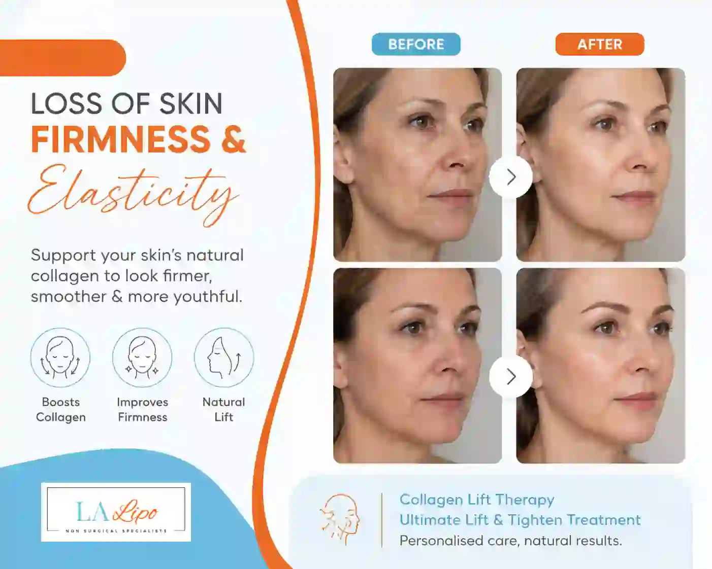 Sign #7: Loss of Skin Firmness and Elasticity West Mersea