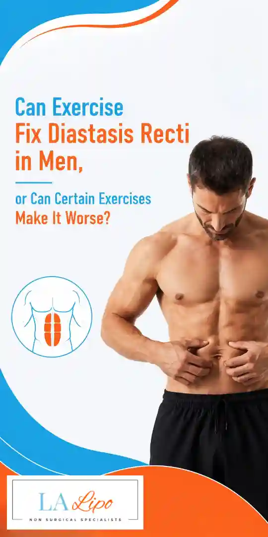 Can Exercise Fix Diastasis Recti in Men, or Can Certain Exercises Make It Worse West Mersea?